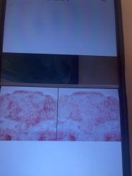 -苑苑vbeauty科技美容SPA