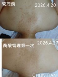 -春田皮肤管理中心品牌旗舰店
