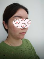 -洁铭新加坡医美