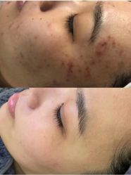 -SOS修丽可.痘肌修复中心