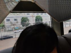 -碧莲盛·不剃发植发