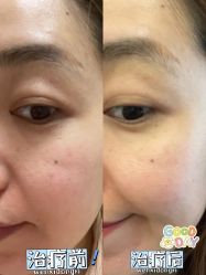 -广州健丽·去眼袋医疗美容机构
