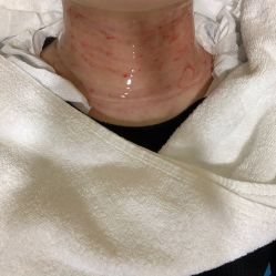 体验后-上海首尔丽格医疗美容医院