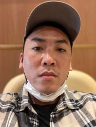 点击看大图 体验前-深圳艺星医疗美容医院