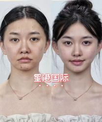 -星港国际·Skin皮肤专研·皮肤管理