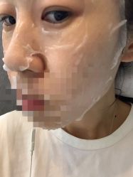 -More摩尔医美の注射线雕光电中心