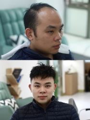 -发饰美男士增发补发假发定制店