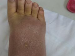 -大韩庄韩氏祖传正骨