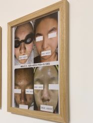 -美肤盾祛痘·问题肌头疗管理中心