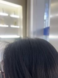-北京雍禾植发医院