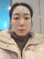 体验前-上海华美医疗美容医院