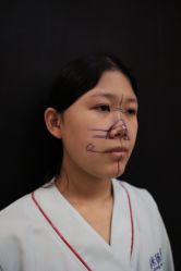 -北京米扬丽格医疗美容·联合丽格鼻整形中心