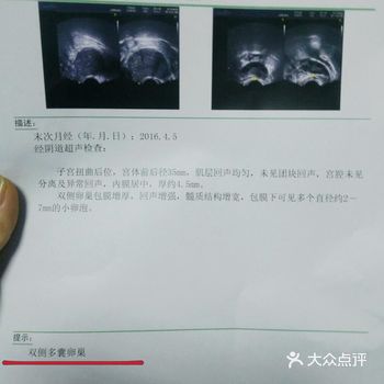 9种可以调理多囊的食物