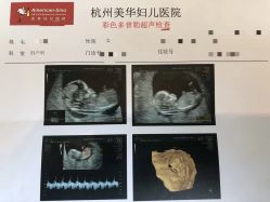 -杭州贝瑞斯美华妇儿医院·早孕·产检·儿科