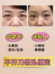 -广州健丽·去眼袋医疗美容机构