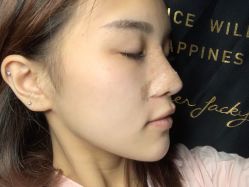 -东莞缔美美容医院