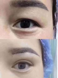 点击看大图 -上海漾颜医疗美容