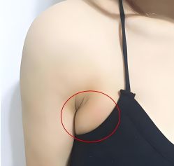-丽减美瘦吧·减肥瘦身
