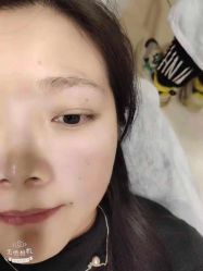 -郡艺医疗美容·微整·眼鼻吸脂