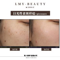 -丽美妍医疗美容·皮秒·立体分层抗衰