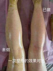-瘦立方身材管理中心