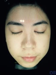 -MedSkinCare科技祛痘肌肤修护中心
