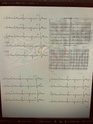 点击看大图 -PinooTattoo皮奴刺青纹身设计总部