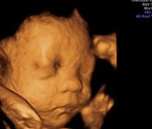 -郑州万安妇产医院