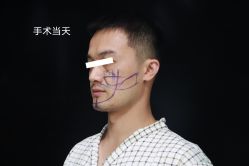 -禾美嘉医疗美容