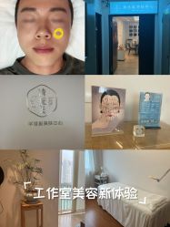 -清疣美疣·痣·斑净肤中心