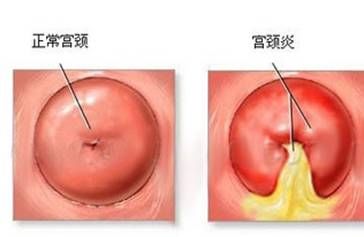 -邢台妇产医院