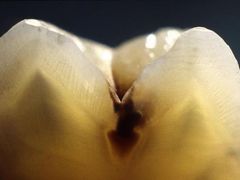 -同步齿科·数字化正畸种植口腔中心(珠海店)