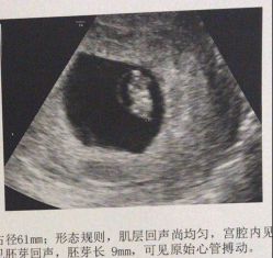 -上海艾儿贝佳妇产科医院