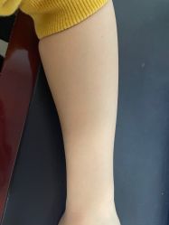 体验后-重庆军美医疗美容医院