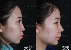 -北京米扬丽格医疗美容·联合丽格鼻整形中心