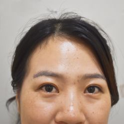 -天津健丽·去眼袋医疗美容机构