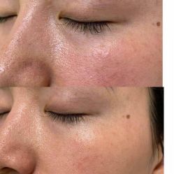 -苑苑vbeauty科技美容SPA