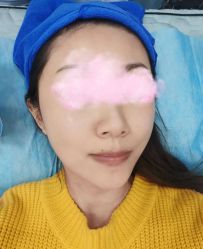 体验后-紫洁俪方（北京）医疗美容