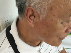 -宁耳听力助听器奥迪康·峰力·西门子(宝山店)