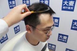 -大麦微针植发丨全国连锁