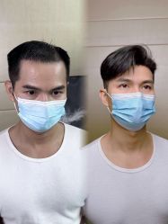 -型男帮男士假发补发·佩戴式发型