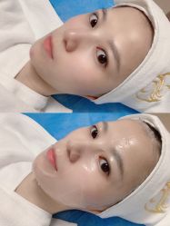 点击看大图 -圣嘉新医疗美容医院