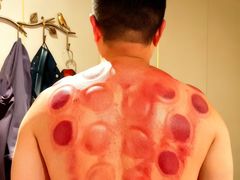 -正清和·推拿养生(黑石礁中心店)