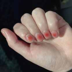 -JNK皮肤管理中心