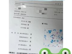 -广州仁爱天河医院