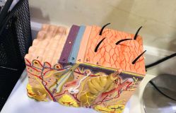 体验前-雍禾植发全国连锁