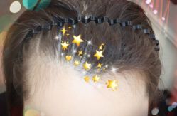 -大麦微针植发全国连锁