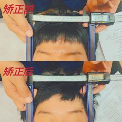 -颜和骨正·明哲式骨相美学整骨