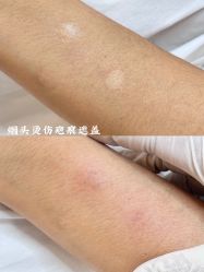 -德绣·机器野生眉发际线·美瞳线半永久