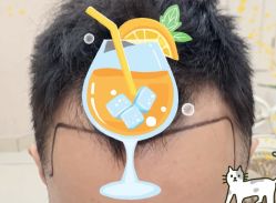 -大麦微针植发全国连锁